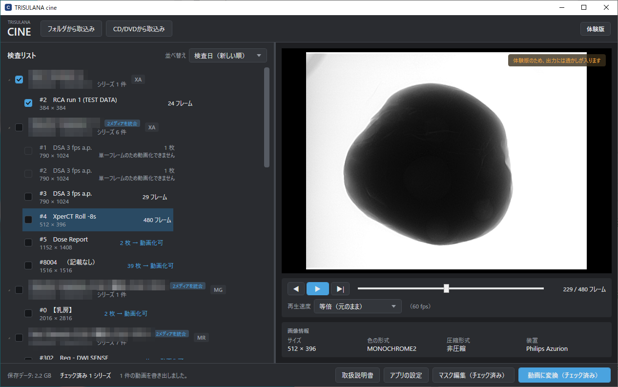TRISULANA cine のメイン画面。左に検査リスト、右に動画のプレビュー